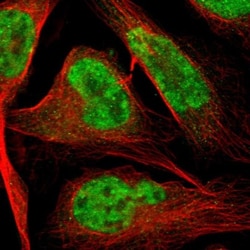 HIV-1 Tat specific factor 1 Antibody, Novus Biologicals 0.1mL; Unlabeled:Antibodies,